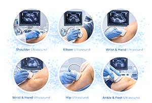 MSK Ultrasound Scans We Offer