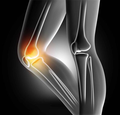 joint pain treatment clinic milton keynes non surgical pain management injections uk musculoskeletal injection therapy specialist